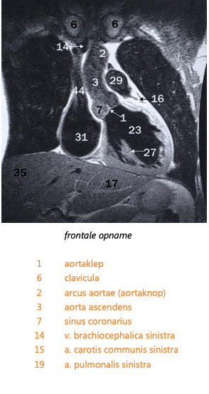 Mediastinum 2