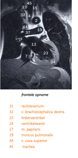 Mediastinum 3
