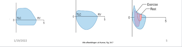 Waar in de luchtwegen zijn de obstructies van deze drie spirometrische grafieken gecentreerd? (Intrathoracaal of Extrathoracaal)