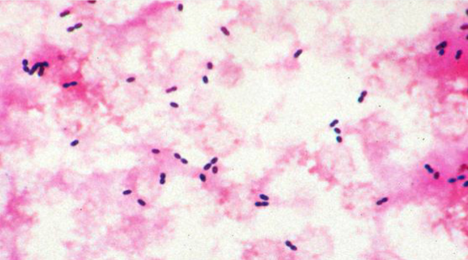 Welke bacteriën zijn dit?