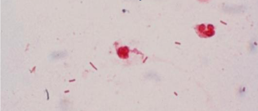 Welke bacteriën zijn dit?