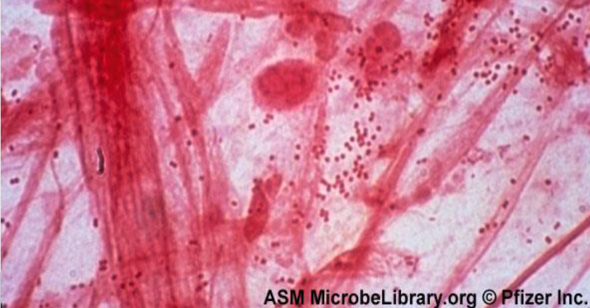Welke bacteriën zijn dit?