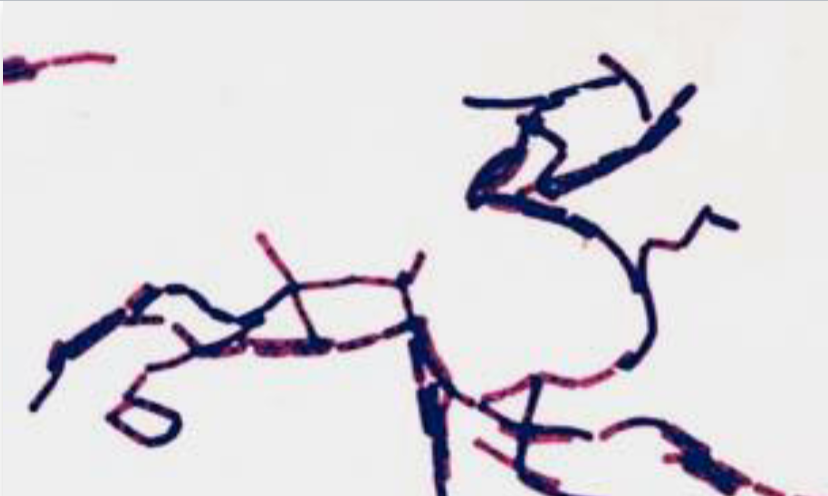 Welke bacteriën zijn dit?