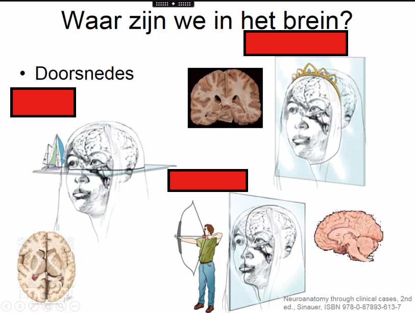 Welke drie doorsnedes zijn dit?