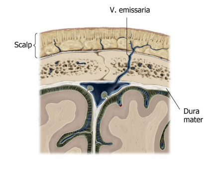 Hoe kunnen herseninfecties ontstaan door de v. Emmisaria?