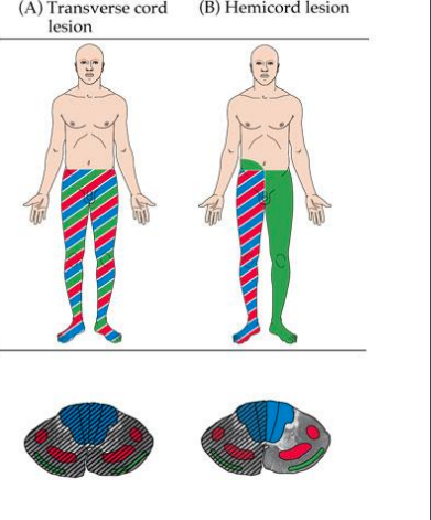 Welke zenuwpathways binnen het ruggenmerg geven blauw, rood en groen aan?