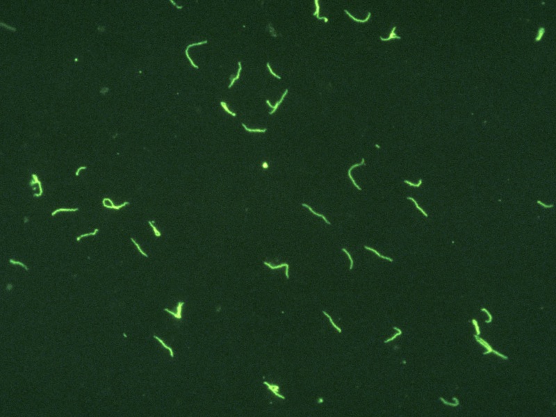 Wat is deze aandoening? Welke DD overweeg je? Geef een korte samenvatting.