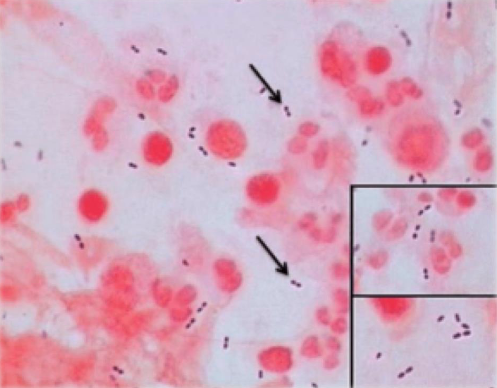 Welke mogelijke verwekkers van meningitis zijn dit? #1
