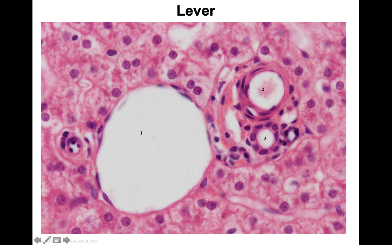 Hoe onderscheiden we verschillende celonderdelen in de driehoek van Kiernan uit de lever? College Jack 'HC Pancreas en Lever'