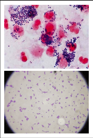 Omschrijf deze bacteriën. Benoem ook de naam.