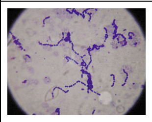 Omschrijf deze bacteriën. Benoem ook de naam.