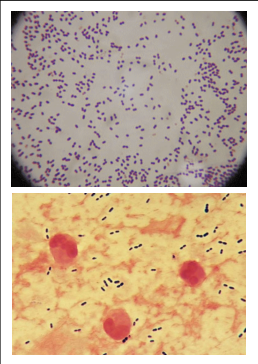 Omschrijf deze bacteriën. Benoem ook de naam.
