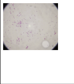 Omschrijf deze bacteriën. Benoem ook de naam.