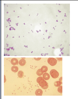 Omschrijf deze bacteriën. Benoem ook de naam.