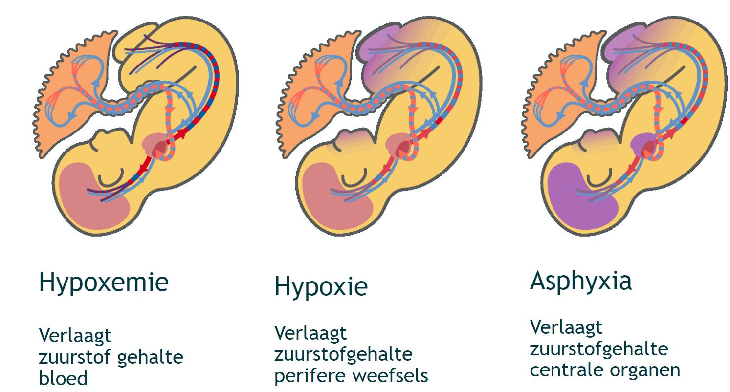 Zuurstof abnormaliteiten